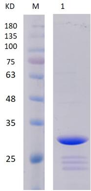 12% SDS-PAGE analysis profiles of purified PA2688-26-256 (CBB stained).